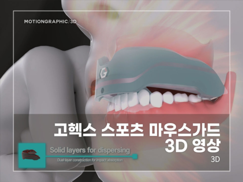 고헥스-스포츠-마우스가드-3D-영상